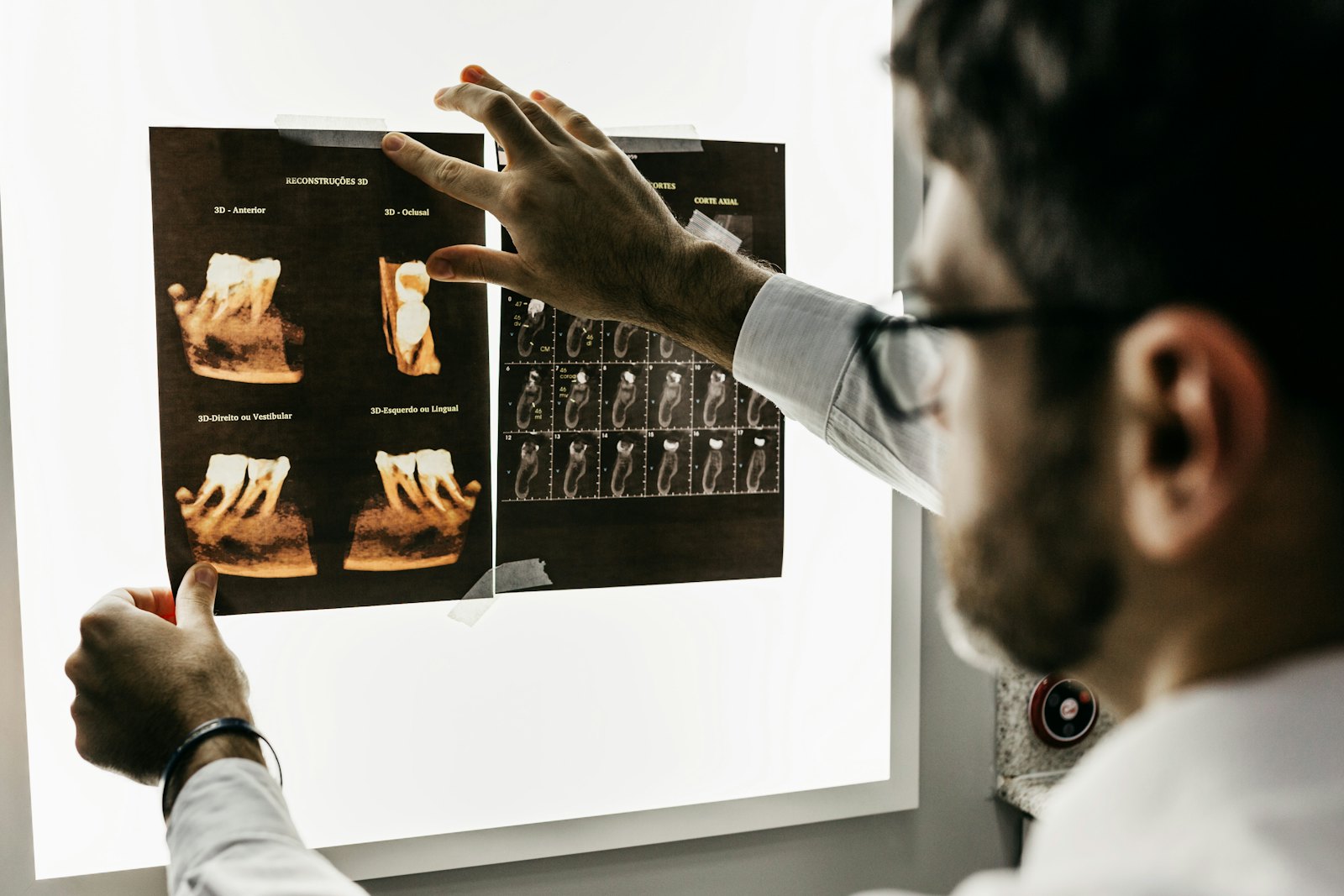 Pearl Dental Studio dentist reviewing 3D dental scans on a lightbox